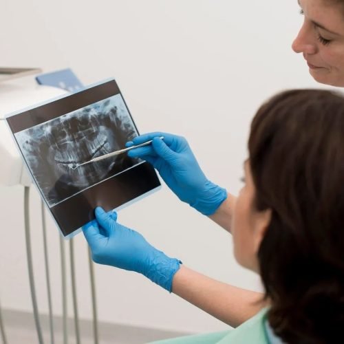 imgi 21 female patient looking radiography her teeth with dentist 23 2148985762 2880w